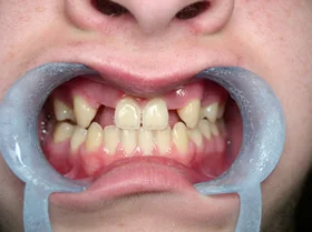 Case 3 — before treatment