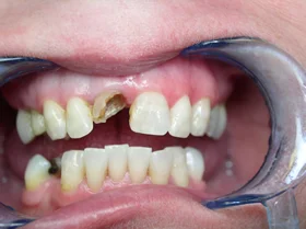 Case 6 — before treatment