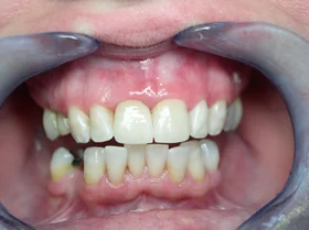 Case 6 — after treatment