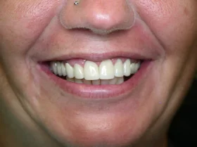 Case 2 — after treatment