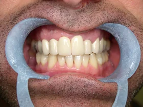 Case 5 — after treatment