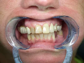 Case 1 — before treatment