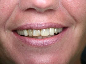 Case 2 — before treatment