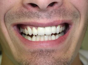 Case 4 — after treatment