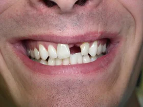 Case 4 — before treatment