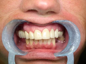 Case 1 — after treatment