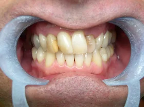 Case 5 — before treatment